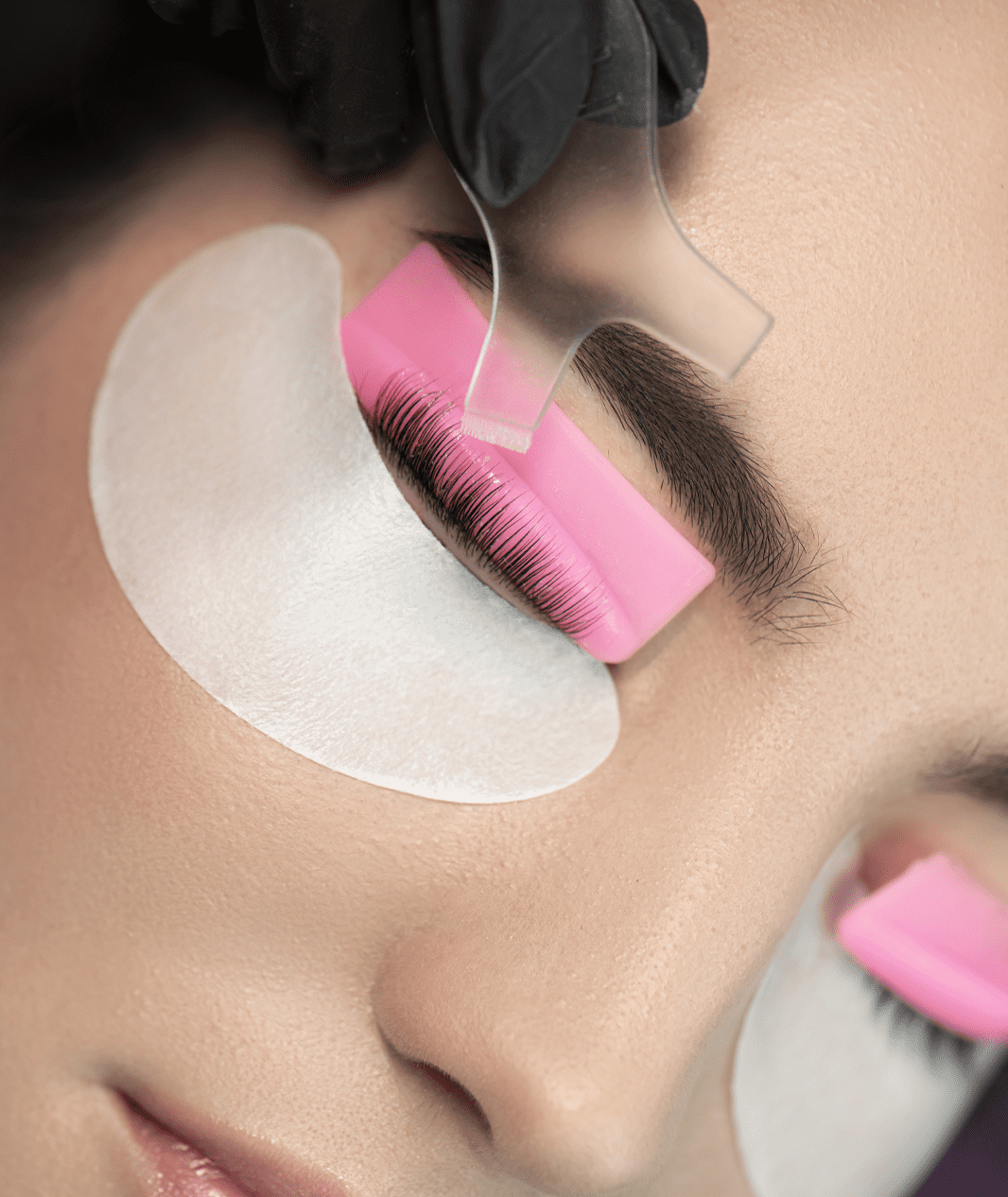 Browlifting